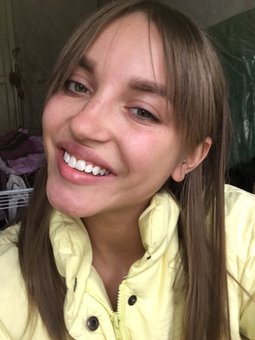 Teeth whitening in the dental clinic &quot;zhemchug&quot; in kharkov. apply for a discount.