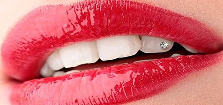 Акции в стоматологической клинике «Nazaria Dental»