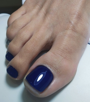 Discount medical pedicure