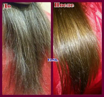 Treat hair in the QueenS salon in Nikolaev. Make an appointment with a trichologist for a special offer.