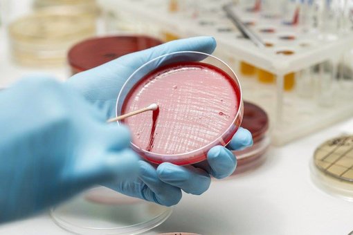 Лабораторія «Invitro». Знижки на аналізи