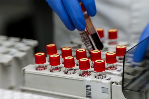 Лабораторія «Invitro». Знижки на аналізи